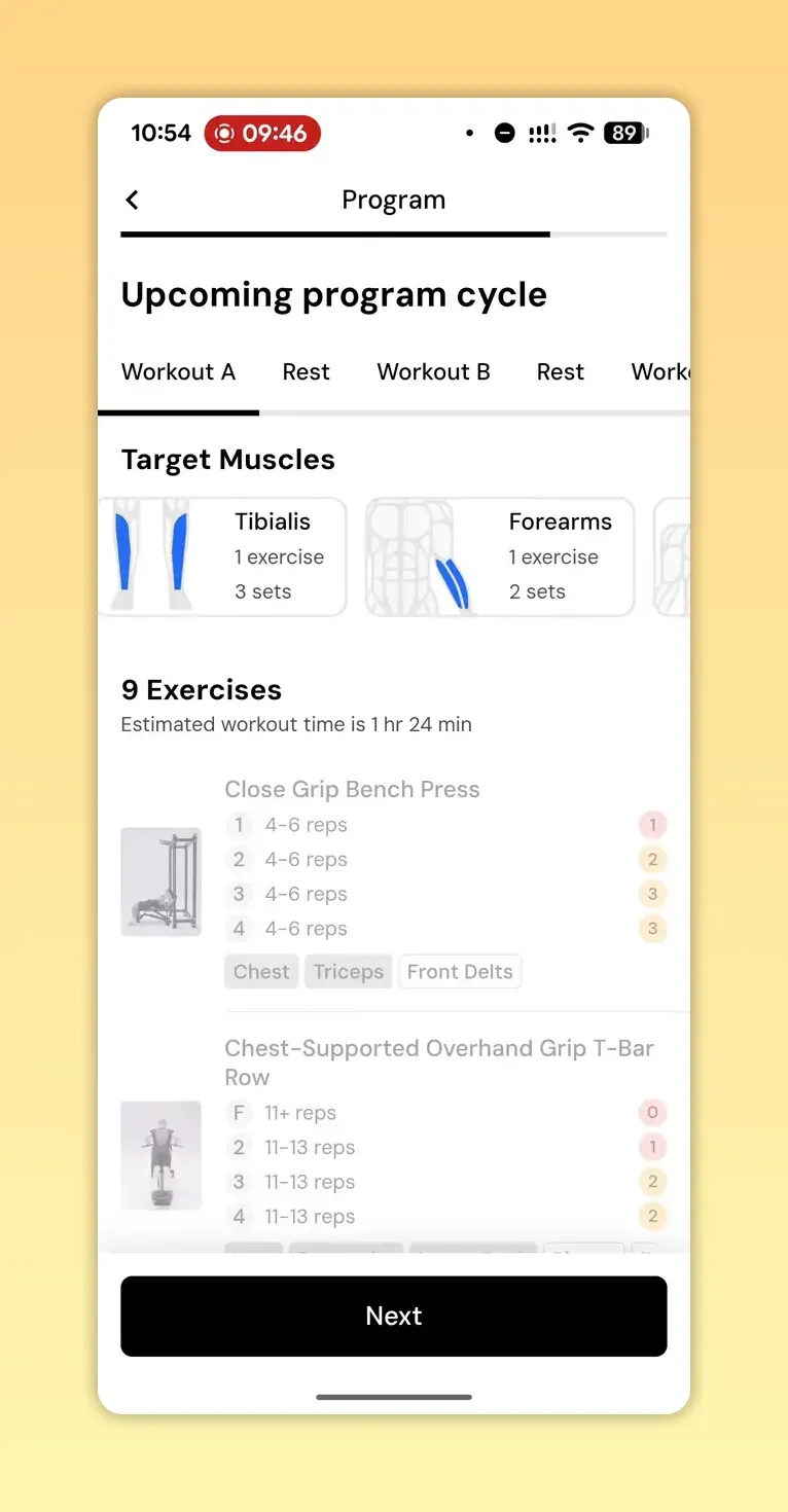 MacroFactor Workouts target muscles screen showing Tibialis and Forearms with exercise and set counts